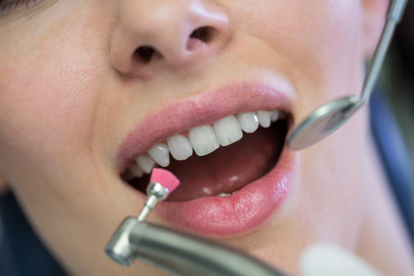 How Long After Fluoride Treatment Can I Eat?
